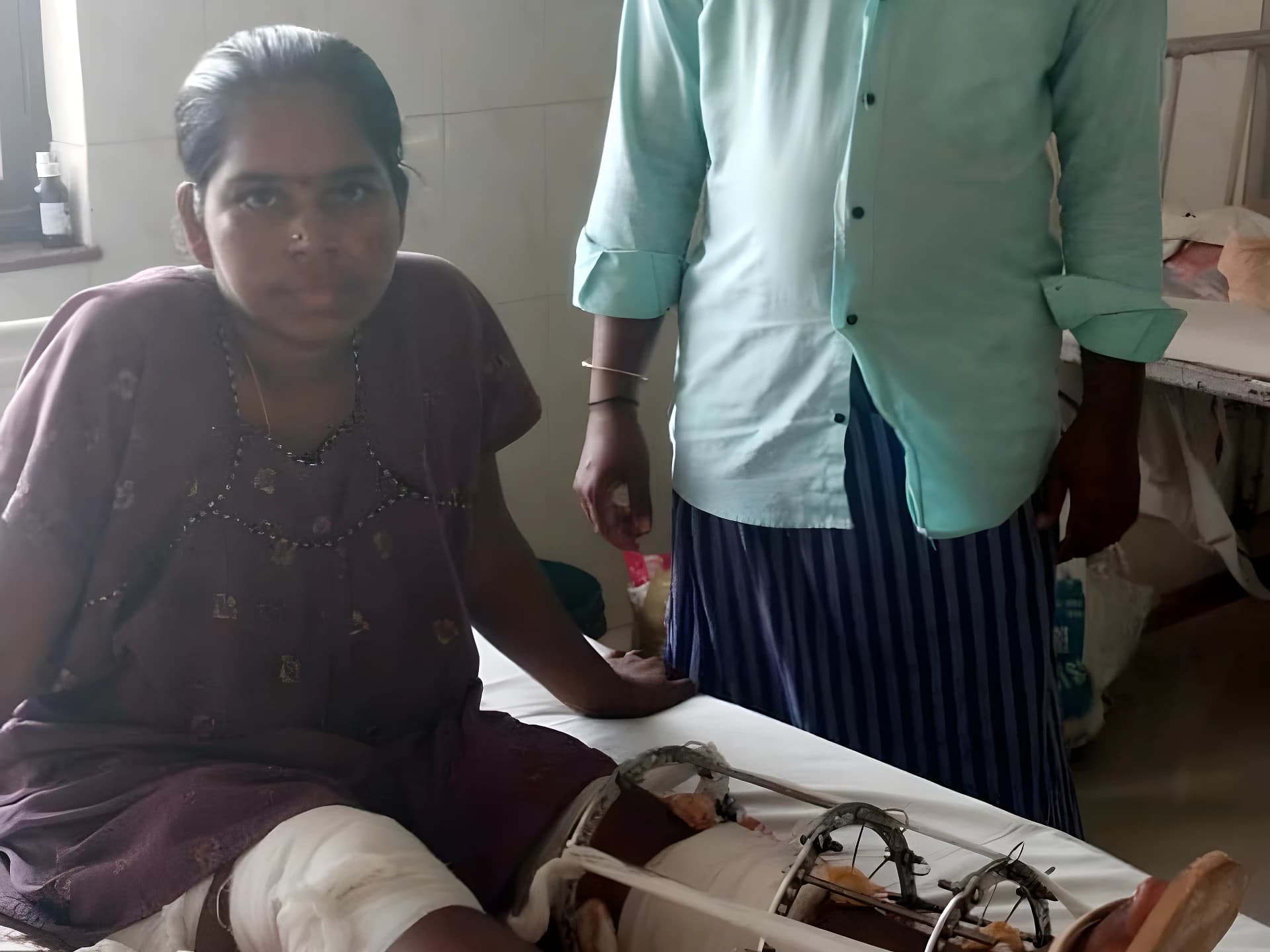 ప్రమాదంలో రెండు కాళ్లు విరిగి.. దాతల కోసం ఎదురుచూపులు