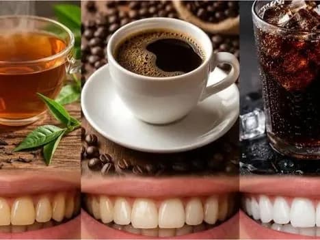 మీ పళ్లు సేఫ్గా ఉండాలంటే ఇలా చేయండి!