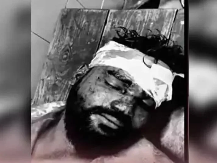 TDP కార్యకర్తపై కర్రలు, రాళ్లతో దాడి