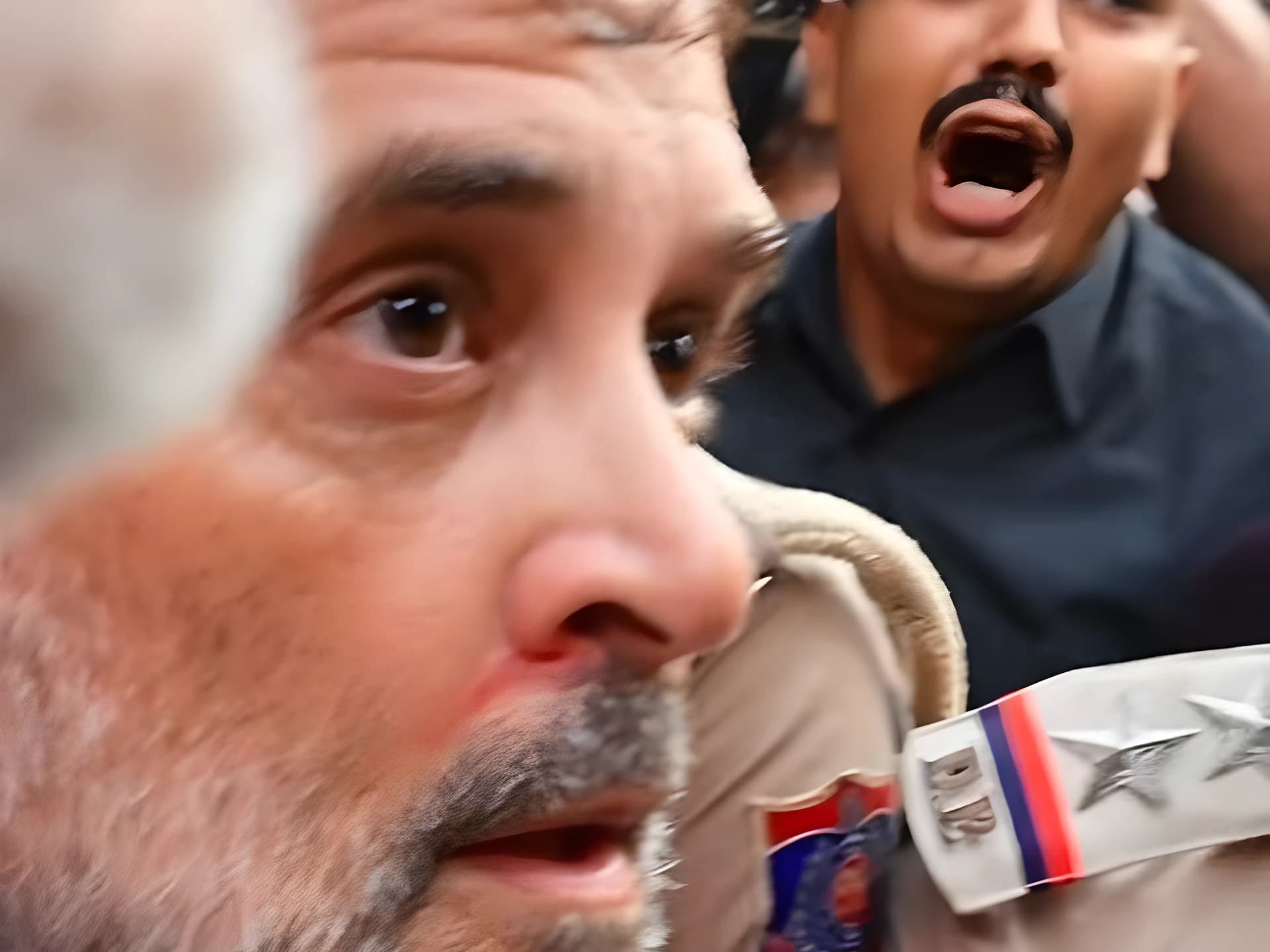 రాహుల్ ముక్కునుంచి బ్లడ్ ! పెనుగులాటలో మెడ, చేతులకు గాయాలు