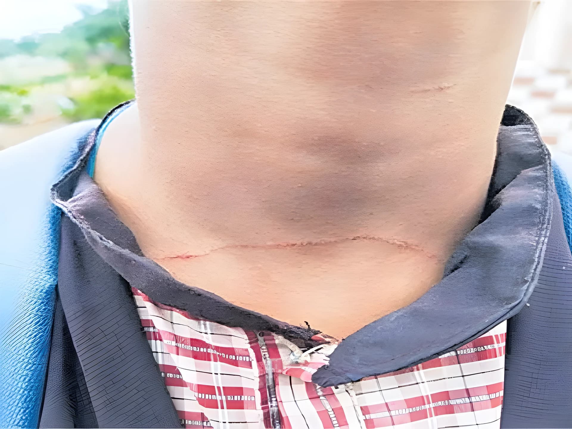 హాస్టల్లో విద్యార్థినుల గొంతు కోసే ప్రయత్నం