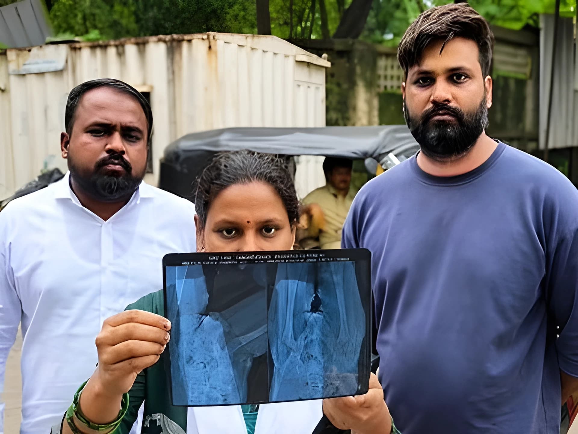 అయ్యో పాపం: చిన్నారి బాడీలో ఇరుక్కుపోయిన సూది!
