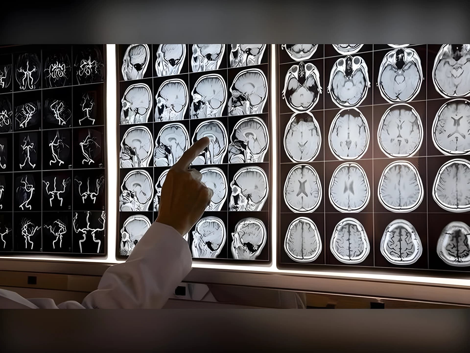 ‘బ్రెయిన్ ఫాగ్’తో జాగ్రత్త!