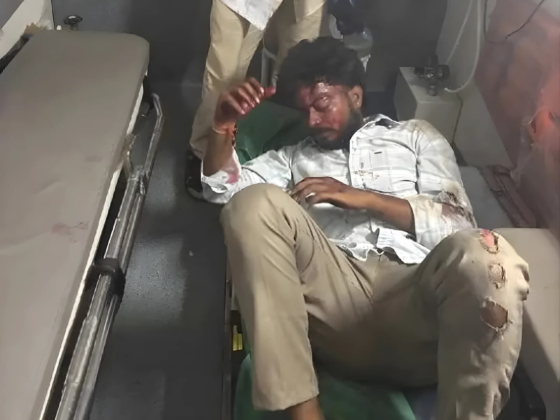 రెండు బైకులు ఢీ.. ఇద్దరికి తీవ్ర గాయాలు