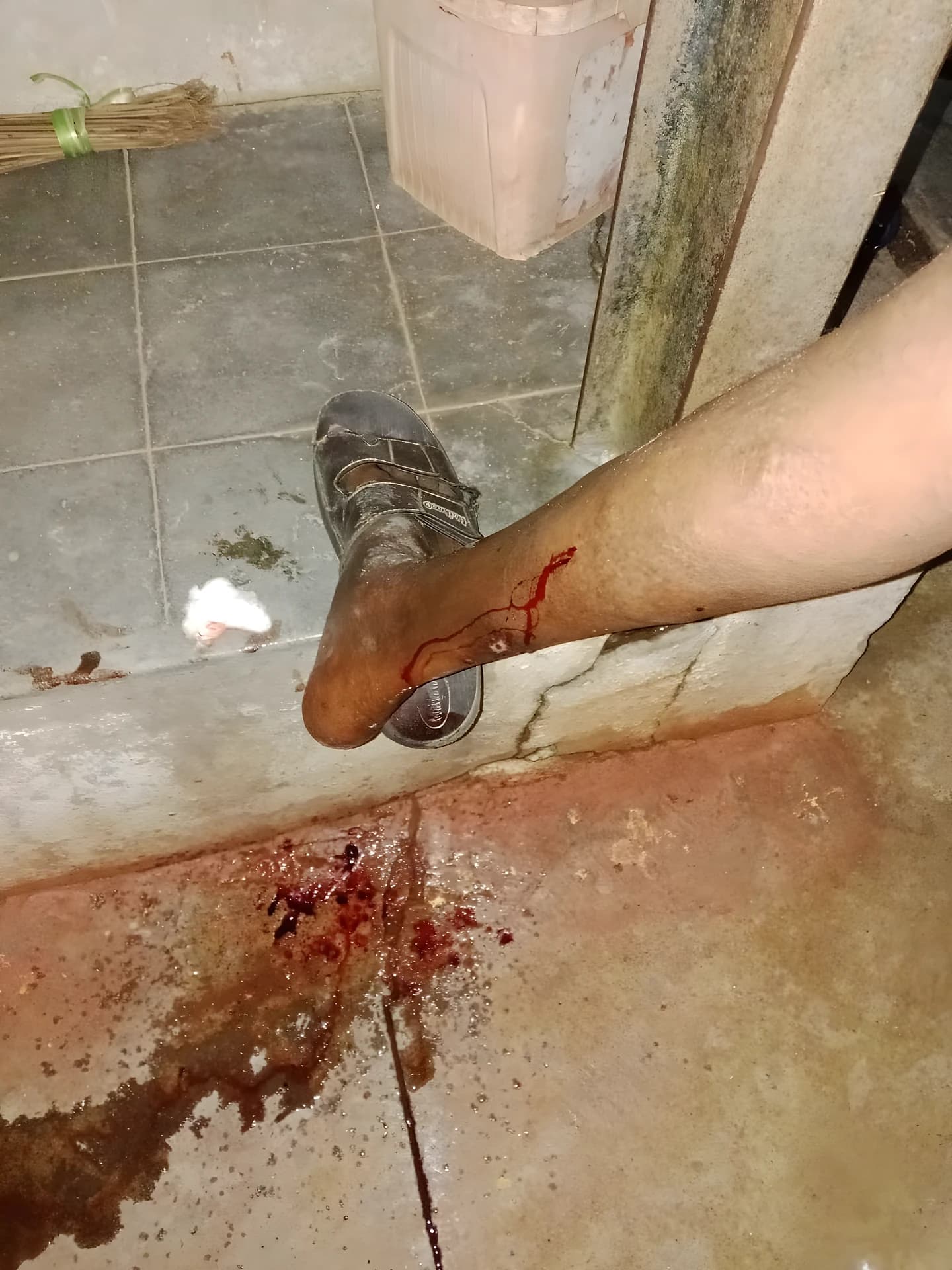 నాగర్కర్నూల్లో Dog అటాక్!