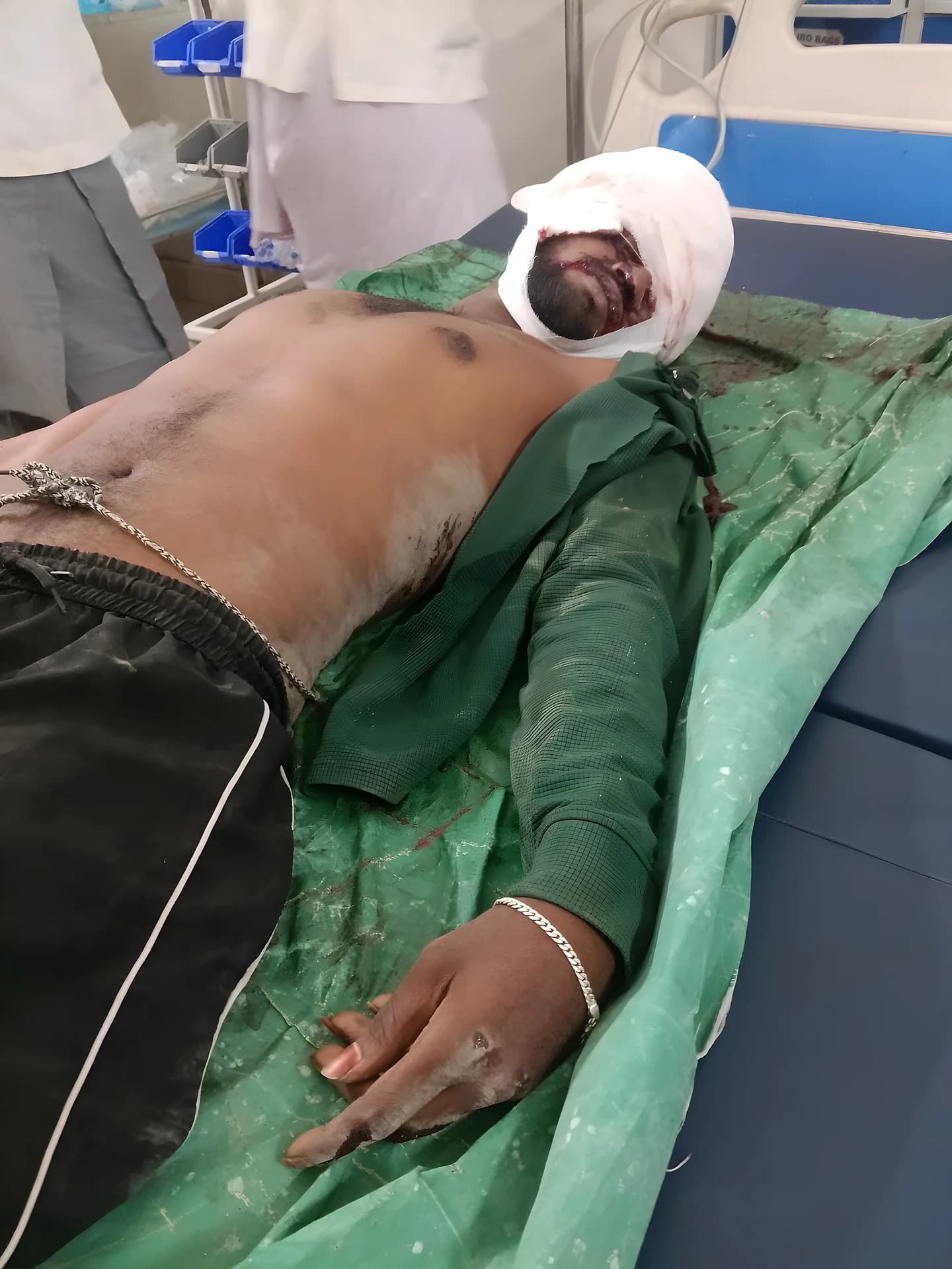 కారు–బైక్ ఢీ.. యువకుడి పరిస్థితి విషమం