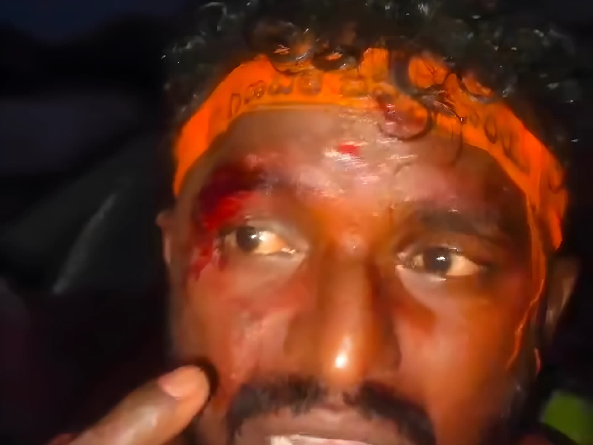 గంగాసాగర్లో కుల వివక్ష దాడి: ఇద్దరు SC యువకులకు గాయాలు