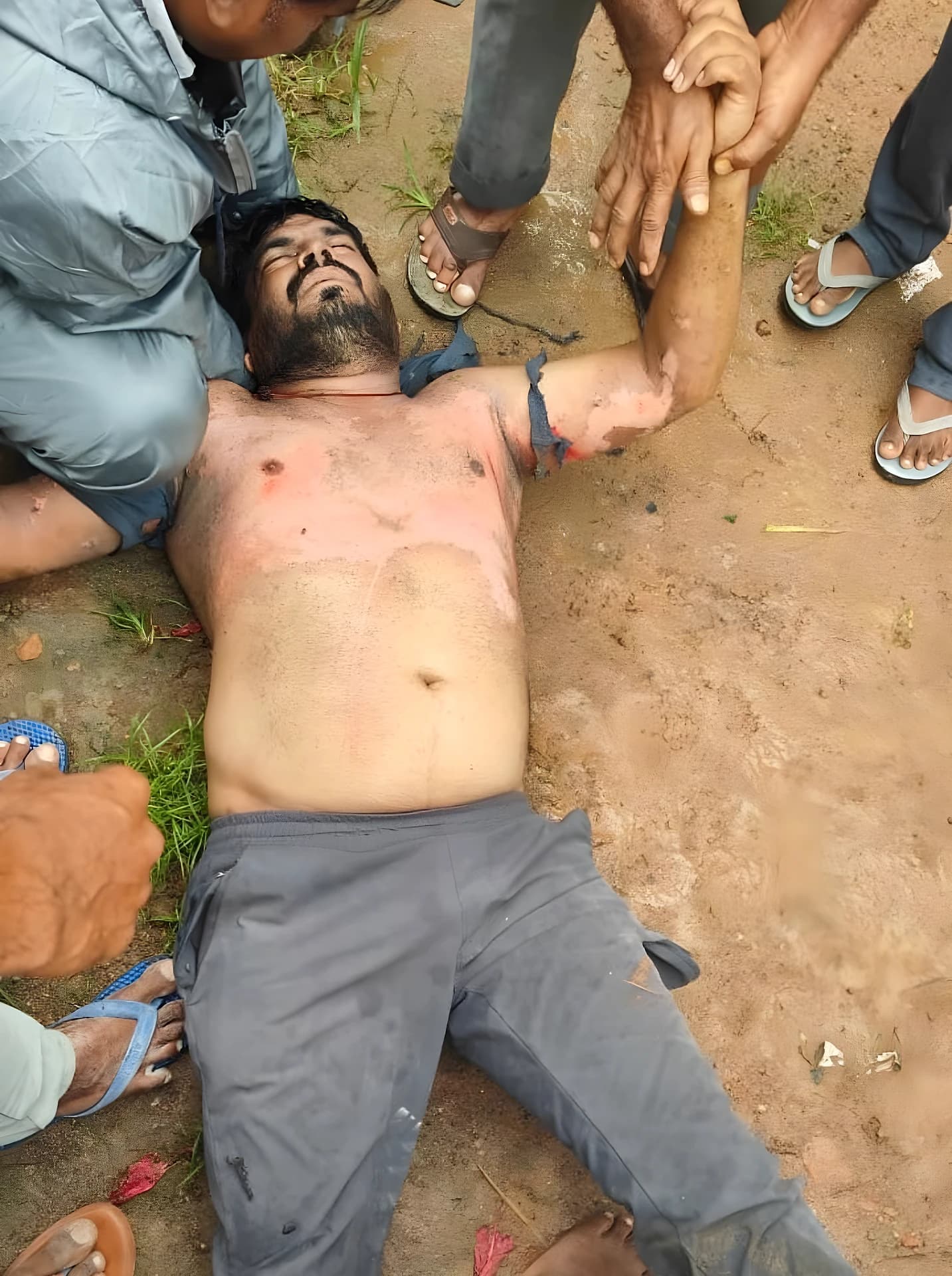 కరెంట్ షాక్తో లైన్మెన్కు తీవ్ర గాయాలు